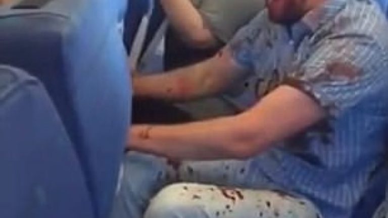 Lëndonte vetën dhe bërtiste, duke tmerruar të udhëtarët e aeroplanit (Video, +18)