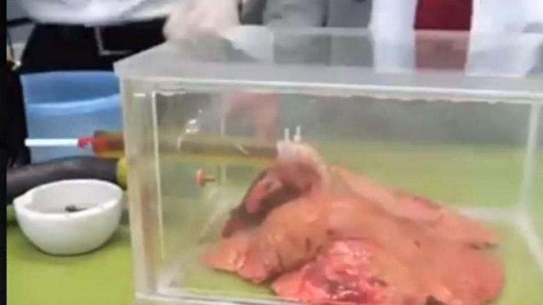 Videoja e cila do t’ju bëjë ta lini duhanin: Si duken mushkëritë e shëndetshme vetëm pas 20 cigareve (Video)