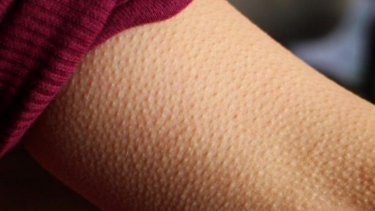 Nëse muzika ju rrëqethë, truri juaj mund të jetë i veçantë