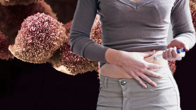 Diabeti e rritë rrezikun e kancerit në pankreas