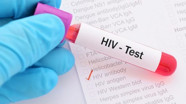 Shpresë për miliona njerëz – shkencëtarët shumë afër ilaçit që e shëron HIV-in