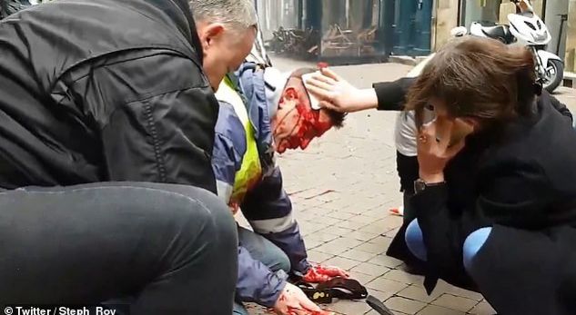 Policia franceze ia gjakos kokën zjarrfikësit që iu bashkua protestuesve