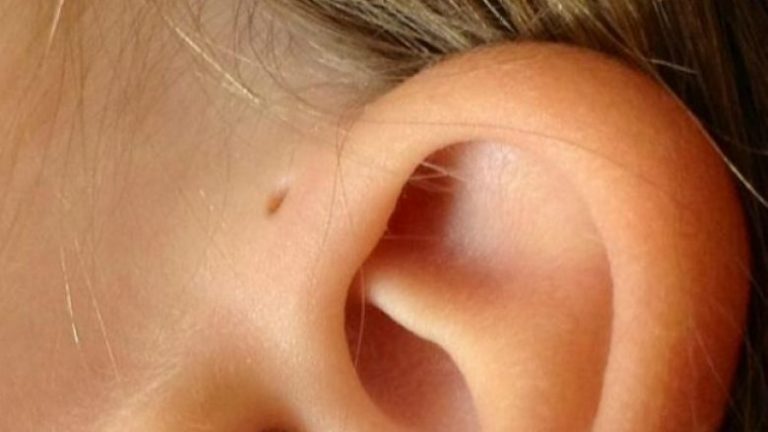 Karakteristikat trupore të cilat gjenden vetëm në 5 përqindëshin e botës