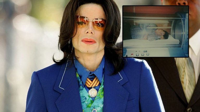 Aparatura e posaçme që e përdorte Michael Jackson për ta luftuar plakjen: Do të jetoj së paku 150 vjet!