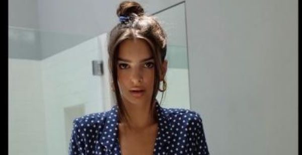 Modelja pozon e pa depiluar për revistën e njohur: Është e drejta ime