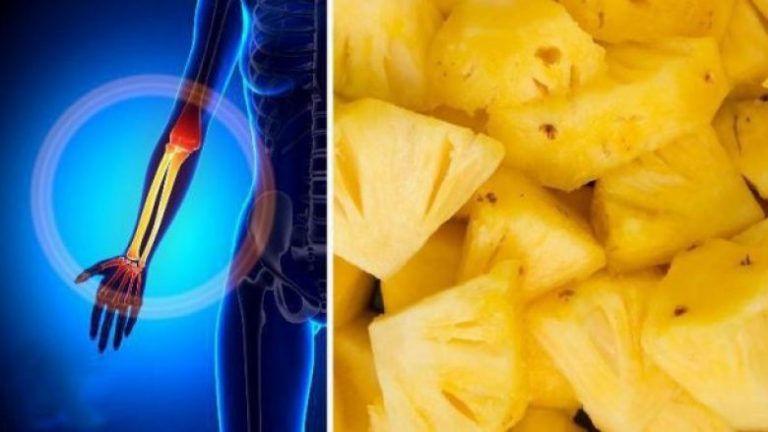Pesë arsye pse duhet të filloni të hani ananas sa më shpesh