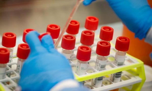 34 të tjerë të infektuar, 222 raste të konfirmuara në Serbi