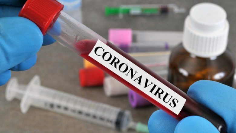 Lipjani sonte me më së shumti raste me koronavirus, kështu radhitën komunat tjera