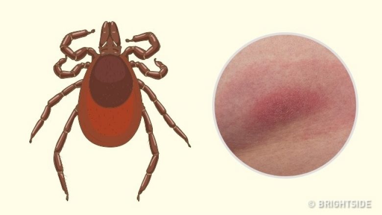 Pickime insektesh që kushdo duhet të jetë në gjendje t’i identifikojë