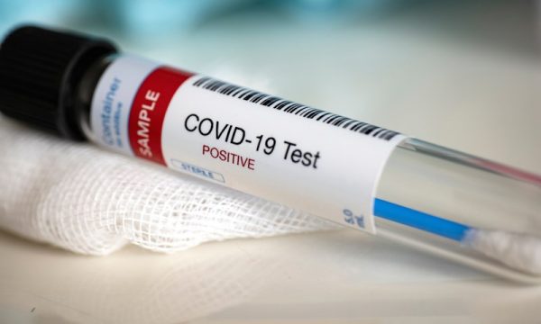 Sa është numri i rasteve aktive në Kosovë pas 129 rasteve të reja me koronavirus?