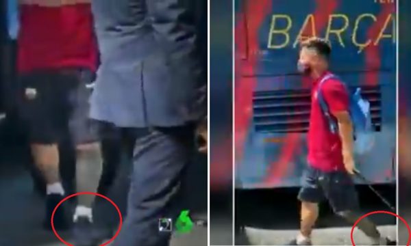 Pamje shqetësuese të Messit para ndeshjes me Bayernin