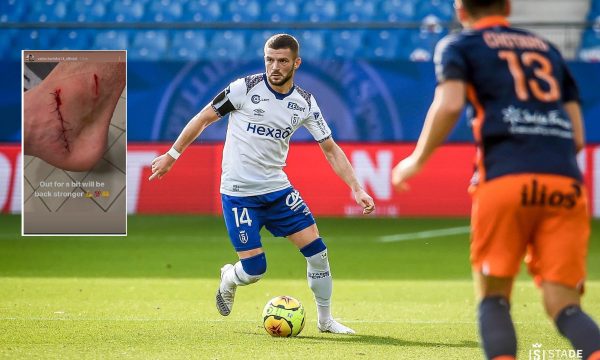 Lëndohet Berisha, publikon foto të këmbës së shqyer