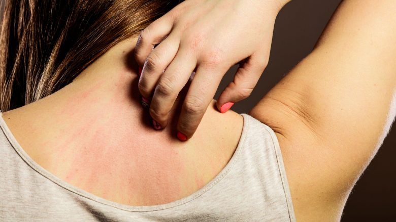 Këto ndryshime të lëkurës mund të jenë një alarm për disa probleme