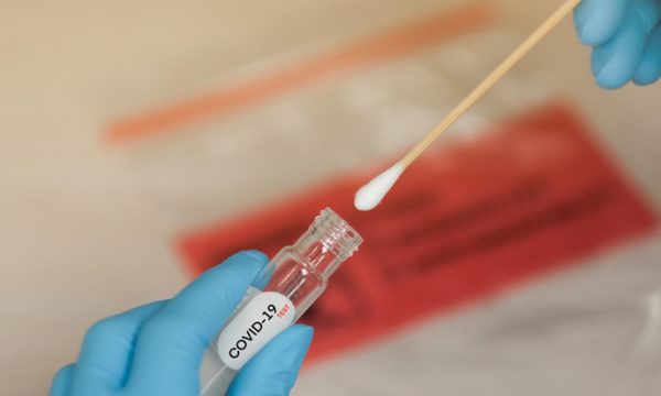 Mërgimtarja nga Zvicra falsifikoi testin COVID-19 në Kosovë, zbulohet nga gruaja e shefit