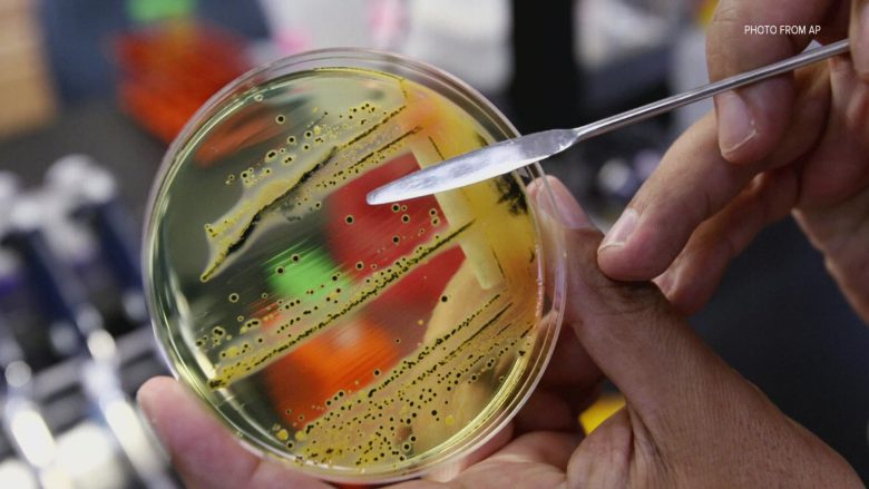 Si ta luftoni bakterin “Escherichia coli”?