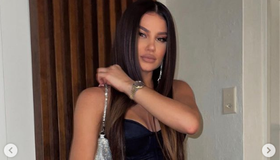 Mahnitë Dhurata Dora, shfaqet super seksi në të zeza