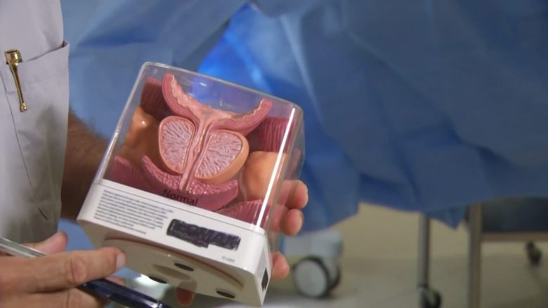 Prostata e rritur: Simptomat dhe si shërohet