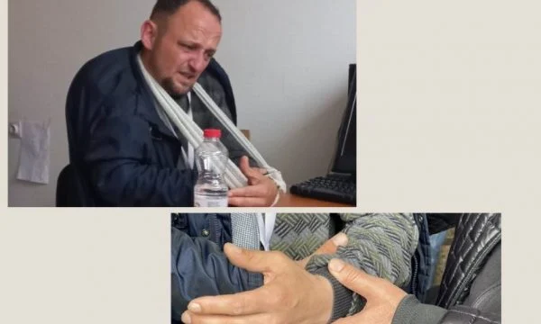 Gazetarit Pleurat Salihu ia thyejnë krahun sulmuesit në veri