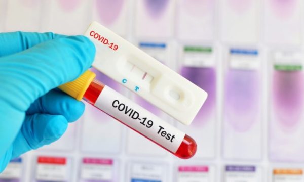1 i vdekur dhe 67 raste të reja me koronavirus në dy javët e fundit në Kosovë