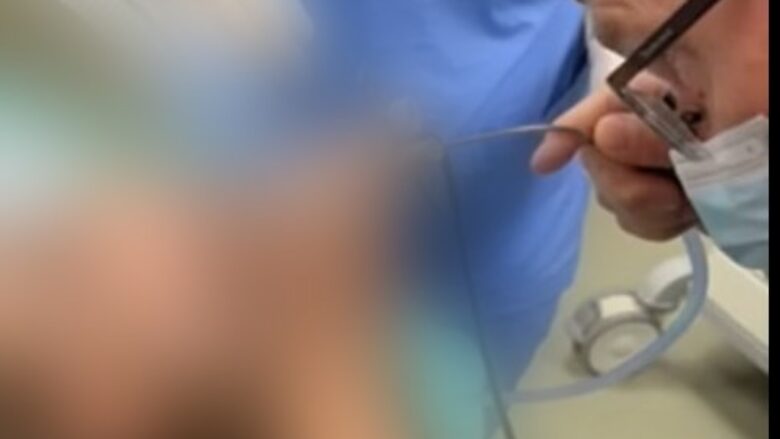 Shpëtohet jeta e një 5-vjeçari në Klinikën e ORL-së, i ishin bllokuar rrugët e frymëmarrjes nga një farë e lulediellit