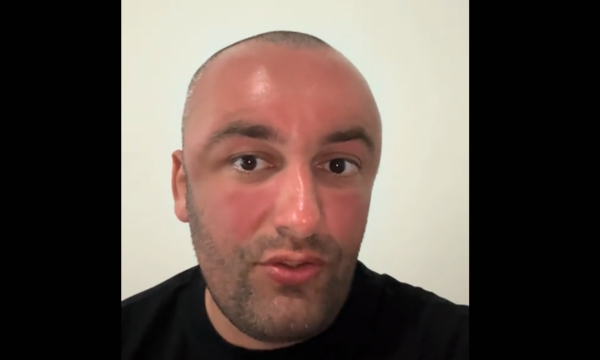 Samedi i “It’s My Home” denoncon publikisht, shfaqet i “stërskuqur” nga botoxi në Kosovë